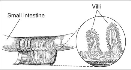 Celiac