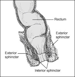 Fecal Incontinence