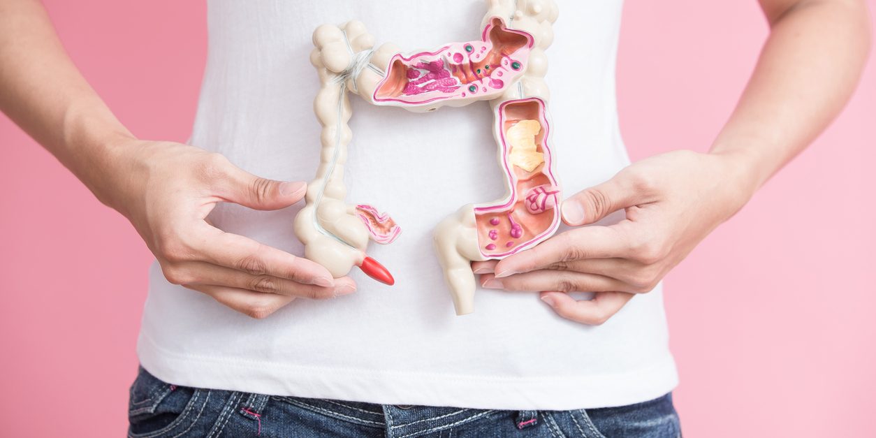 woman holding model of colon against her abdomen