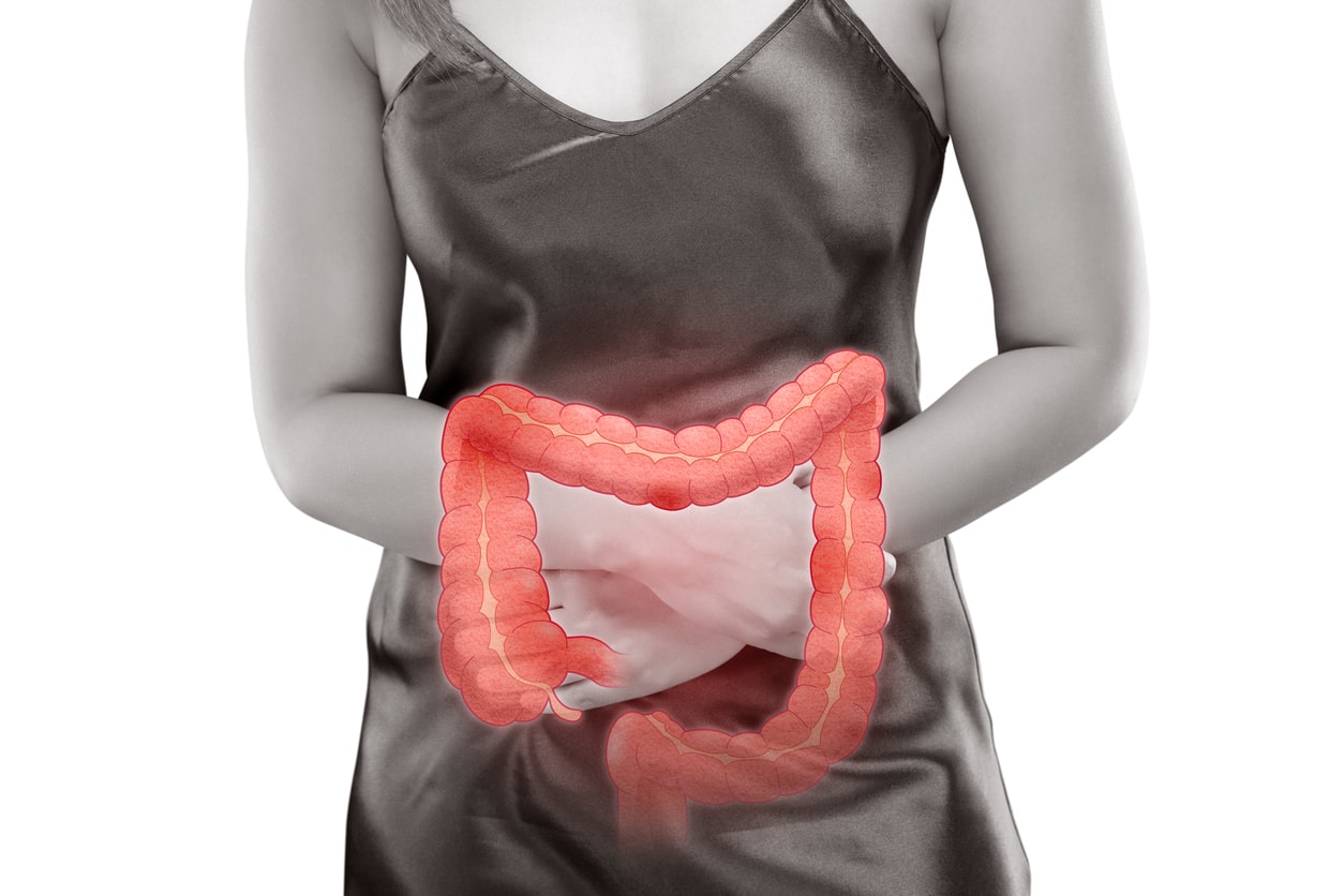 woman gripping abdomen, x-ray of intestine