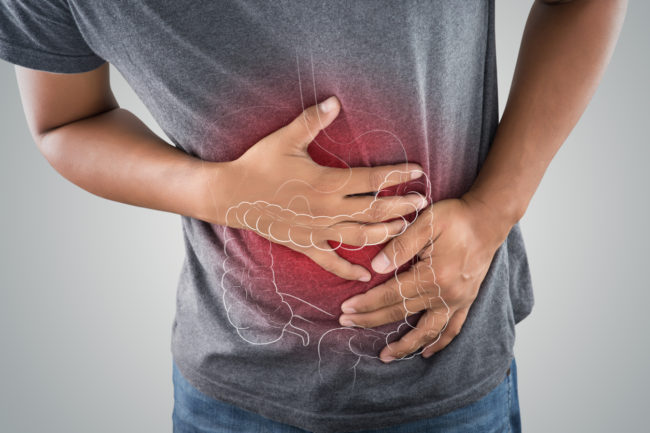 man gripping abdomen, x-ray showing lower intestine