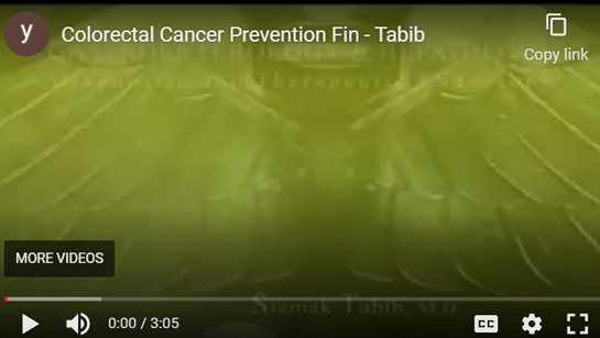 Image of Colorectal Cancer Prevention Click to See Video